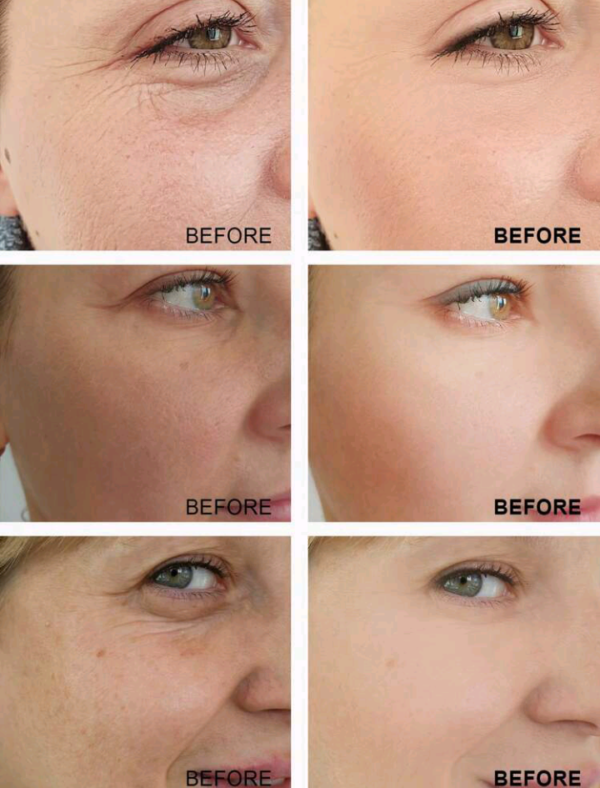 Sefralls 60ml Skincare Face Serum Set - Vitamin C Serum For Radiance, Retinol Serum For Wrinkles - Image 2