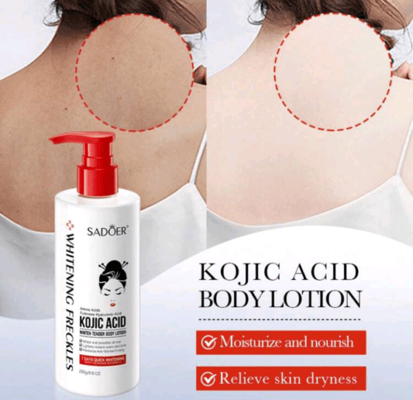250g Quinic Acid Whitening Body Lotion, Moisturizing, Smoothing And Refining Skin Texture, Suitable For Dry And Oily Skin - Image 2