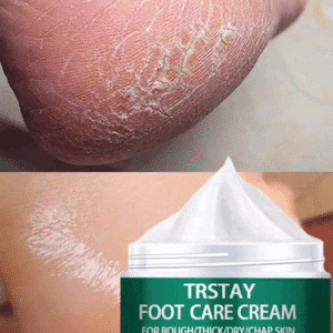 50g Foot Cream For Extremely Dry Cracked&Rough Skin, Exfoliate Dead Skin, Strong Hydration For Dry Cracked Feet And Heel With Plant Squalane