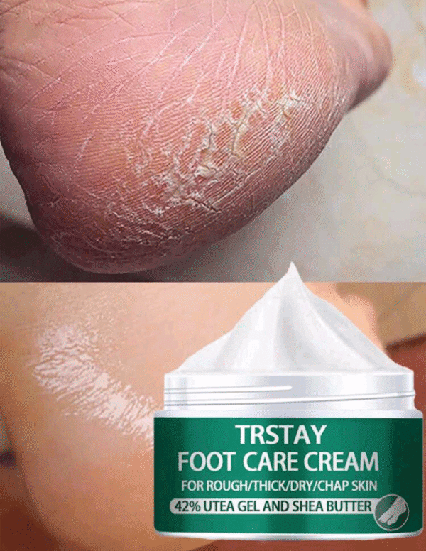 50g Foot Cream For Extremely Dry Cracked&Rough Skin, Exfoliate Dead Skin, Strong Hydration For Dry Cracked Feet And Heel With Plant Squalane