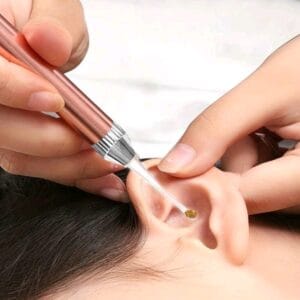 Luminous Ear Spoon Ear Pick - Ear Wax Removal Tool For Adults- Household Ear Cleaner With Light